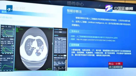 数字化改革：“啄医生”智能辅助诊断助力“健康大脑”建设